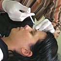 botox